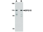 SPG15 Antibody in Western Blot (WB)