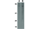 Spred3 Antibody in Western Blot (WB)