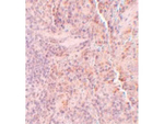 SQSTM1 Antibody in Immunohistochemistry (Paraffin) (IHC (P))
