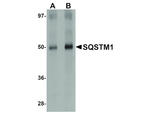 SQSTM1 Antibody in Western Blot (WB)