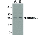 sRANK Ligand Antibody in Western Blot (WB)