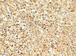 SREBF2 Antibody in Immunohistochemistry (Paraffin) (IHC (P))