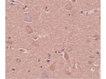 SRPX1 Antibody in Immunohistochemistry (Paraffin) (IHC (P))