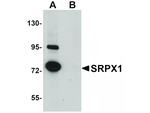SRPX1 Antibody in Western Blot (WB)