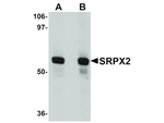SRPX2 Antibody in Western Blot (WB)