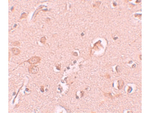 STAU1 Antibody in Immunohistochemistry (Paraffin) (IHC (P))