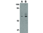 STEAP1 Antibody in Western Blot (WB)