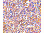 STEAP1 Antibody in Immunohistochemistry (Paraffin) (IHC (P))