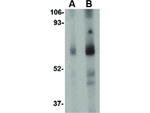 STEAP1 Antibody in Western Blot (WB)