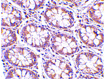 STEAP2 Antibody in Immunohistochemistry (Paraffin) (IHC (P))