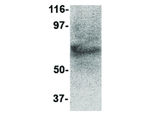 STEAP2 Antibody in Western Blot (WB)