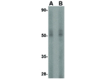 STEAP3 Antibody in Western Blot (WB)