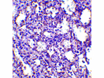STIM2 Antibody in Immunohistochemistry (Paraffin) (IHC (P))