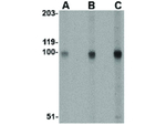 STIM2 Antibody in Western Blot (WB)