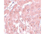 SUMO2/3 Antibody in Immunohistochemistry (Paraffin) (IHC (P))