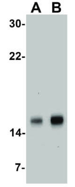 Survivin Antibody in Western Blot (WB)