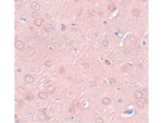 SYNGR2 Antibody in Immunohistochemistry (Paraffin) (IHC (P))