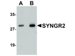 SYNGR2 Antibody in Western Blot (WB)