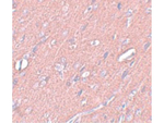 SYNGR3 Antibody in Immunohistochemistry (Paraffin) (IHC (P))