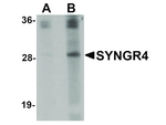 SYNGR4 Antibody in Western Blot (WB)