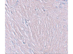 SYNPO Antibody in Immunohistochemistry (Paraffin) (IHC (P))
