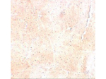 SYNPO2 Antibody in Immunohistochemistry (Paraffin) (IHC (P))