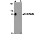 SYNPO2L Antibody in Western Blot (WB)
