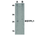 SYPL1 Polyclonal Antibody
