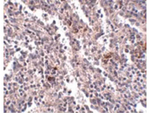 SYPL2 Antibody in Immunohistochemistry (Paraffin) (IHC (P))