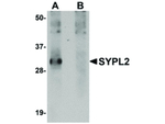 SYPL2 Antibody in Western Blot (WB)