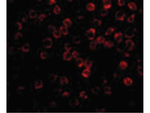 TAB1 Antibody in Immunocytochemistry (ICC/IF)