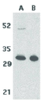 TACI Antibody in Western Blot (WB)