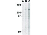 TBC1D1 Polyclonal Antibody