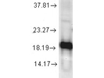 SOD1 Polyclonal Antibody