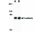 T-cadherin Antibody in Western Blot (WB)