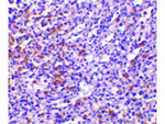 TCCR Antibody in Immunohistochemistry (Paraffin) (IHC (P))