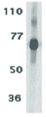 TCCR Antibody in Western Blot (WB)