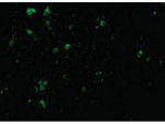 TCCR Polyclonal Antibody