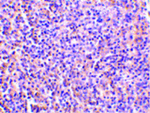 TCCR Antibody in Immunohistochemistry (Paraffin) (IHC (P))