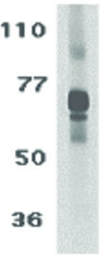 TCCR Antibody in Western Blot (WB)