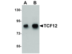 TCF12 Antibody in Western Blot (WB)