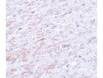 TCF3 Antibody in Immunohistochemistry (Paraffin) (IHC (P))