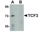 TCF3 Antibody in Western Blot (WB)