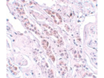 TCTN1 Antibody in Immunohistochemistry (Paraffin) (IHC (P))