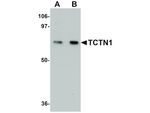 TCTN1 Antibody in Western Blot (WB)