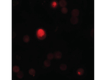 TCTN3 Antibody in Immunocytochemistry (ICC/IF)