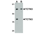 TCTN3 Antibody in Western Blot (WB)