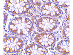 TEM1 Antibody in Immunohistochemistry (Paraffin) (IHC (P))
