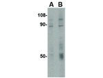 TEM1 Antibody in Western Blot (WB)