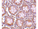 TEM1 Antibody in Immunohistochemistry (Paraffin) (IHC (P))